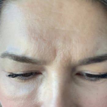 Linemed Aesthetic Linemed Ataşehir Gözaltı Şişliği