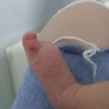 Bower Hastanesi Doğum Sonrası Her Şey