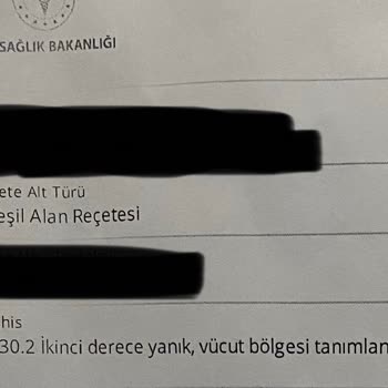 Gratis'ten Aldığım Sıcak Su Torbası Patladı