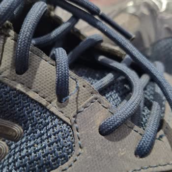 Skechers Dikiş Patlaması Ve Tabanda Aşırı Aşınma