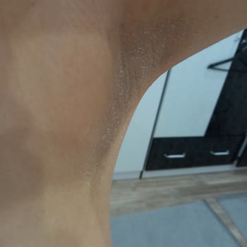 Nivea Black&White Invisible Clear Koltukaltı Sticki Beyazlama Sorunu