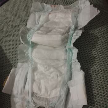 Baby & Me Bebek Bezinin Hatalı Olması