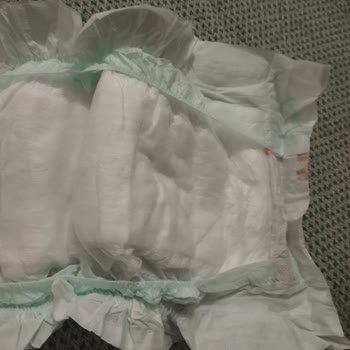 Baby & Me Bebek Bezinin Hatalı Olması