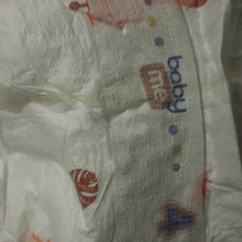 Baby & Me Bebek Bezinin Hatalı Olması