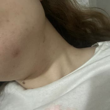 Watsons Kendi Markası Olan Ürünlerin Arkasında Durmuyor