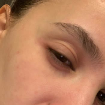 Isana Hydro Booster Roll On Göz Kremi Kızarıklık Ve Şişkinlik Yaptı.