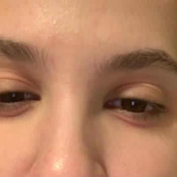 Isana Hydro Booster Roll On Göz Kremi Kızarıklık Ve Şişkinlik Yaptı.