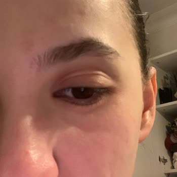 Isana Hydro Booster Roll On Göz Kremi Kızarıklık Ve Şişkinlik Yaptı.