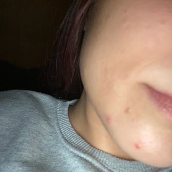 The Purest Solutions The Purest Ürünleri