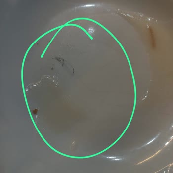 Genç Ömür Dinlenme Tesisi Çorbada Bulaşık Teli Çıkması