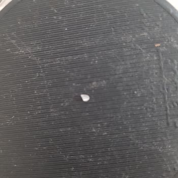 Estetik International Zirkonyum Kaplama Dişler Dökülüyor.