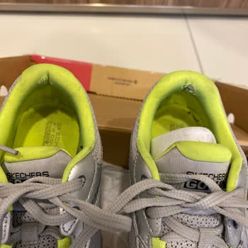 Skechers Mı Bir Daha Asla!