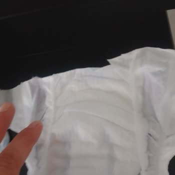 Molfix Anne Kucağı Gibi Kızarıklık Yaptı