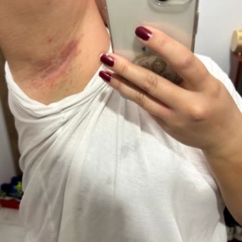 Rossmann Isana Deodorant Cilt Tahrişi