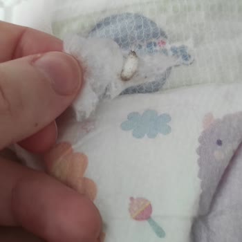 Molfix Pure & Soft Bebek Bezinde Yabancı Cisim