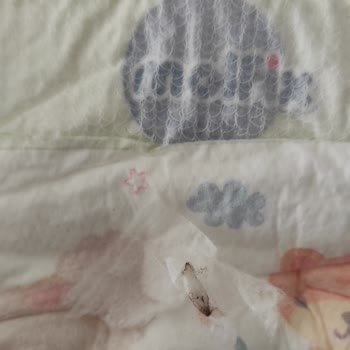 Molfix Pure & Soft Bebek Bezinde Yabancı Cisim