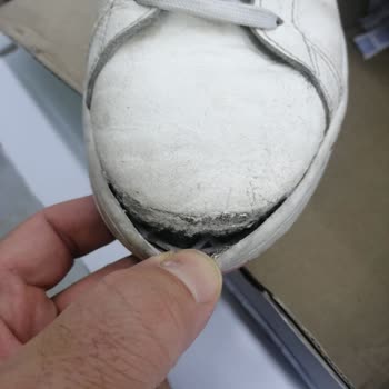 Adidas Tabanı Kopan Spor Ayakkabı Kullanıcı Hatası Denilerek İade Edilmesi