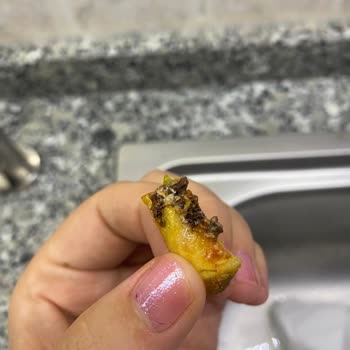 Donas Dürümünün İçindeki Patatesin Böcekli Çıkması.