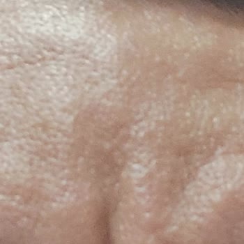 Neutrogena Markalı Yüz Temizleme Jeli (Yüzümde Sivilceler Oluşturdu)