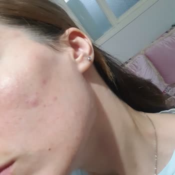 Bee Beauty Cilt Kremi Cildimi Mahvetti