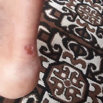 Deichmann Ayakkabı Mağduriyeti Tüketici Mağduriyeti