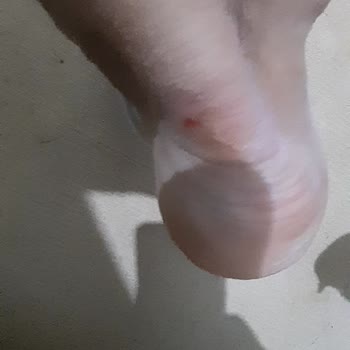 Deichmann Ayakkabı Mağduriyeti Tüketici Mağduriyeti