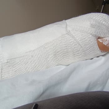 Hattuşa Vacation Thermal Club Tesiste Düştüm Ve Kaderime Terk Edildim