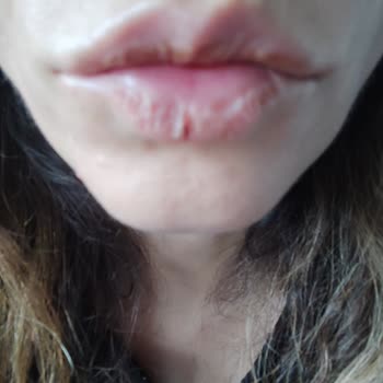 Sephora Lip Gloss Dudağıma Ciddi Zarar Vermesini