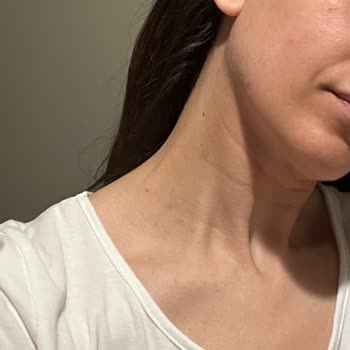 Kiko Milano Kiko Bright Light Serum Ve Nemlendirici Yüzümde Kızarıklığı Sebep Oldu