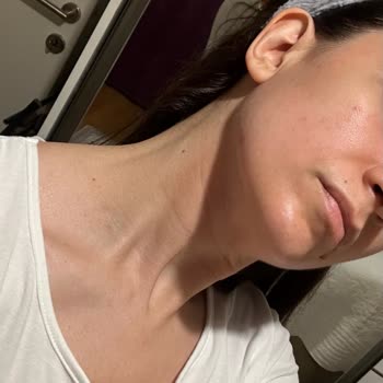 Kiko Milano Kiko Bright Light Serum Ve Nemlendirici Yüzümde Kızarıklığı Sebep Oldu