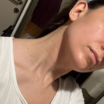 Kiko Milano Kiko Bright Light Serum Ve Nemlendirici Yüzümde Kızarıklığı Sebep Oldu