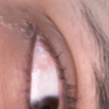 Labella Lens Aldığım Lensler Gözümde Batma ve Kızarıklık Yapıyor