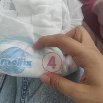 Molfix Bezi Kullanırken Çocuğumun Poposu Yanık Oldu
