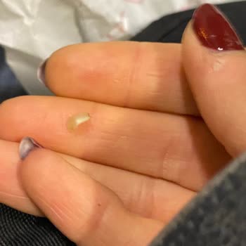 First Sensations First Sakızın İçinden Taş Çıktı?