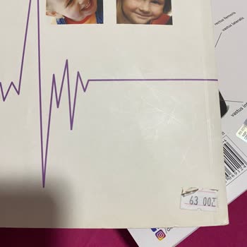 Amazon Kitaplarım Yırtık, Kırışık Ve Eski Basım Geldi.