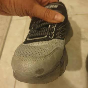 Skechers Ayakkabı 2 Günde Ucu Soyuldu