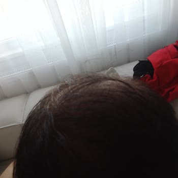 Melikgazi Hastanesi PRP İşleminin 4 Dakikada Bitirilmesi