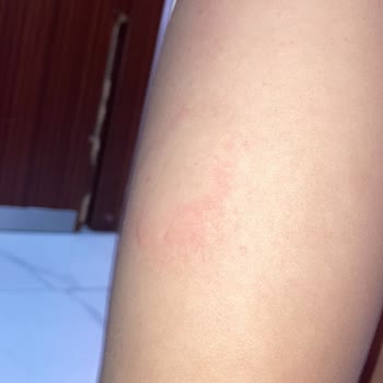 Berko İlaç İburamin Cold Alerji