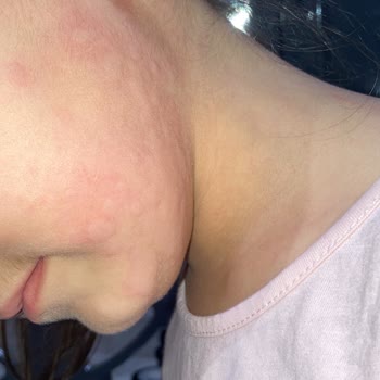 Berko İlaç İburamin Cold Alerji