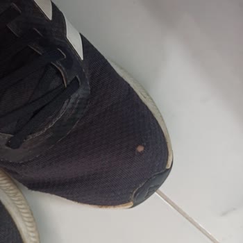 Adidas Ayakkabının 6 Aydan Önce Yırtılıp Değişim Yapılmaması