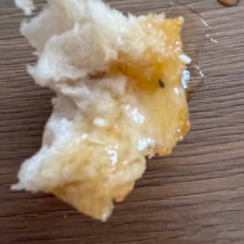 Balparmak Balın İçinden Böcek Çıktı