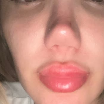 AA Clinic Doktor Hakkında Revizyon Şikayet