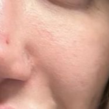 AA Clinic Doktor Hakkında Revizyon Şikayet