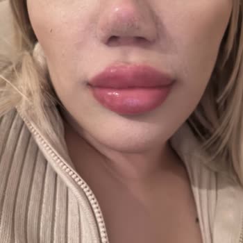 AA Clinic Doktor Hakkında Revizyon Şikayet