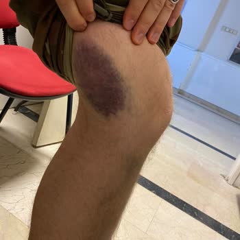 As Adana Seyahat Firması İnsan Canına Değer Verilmemesi