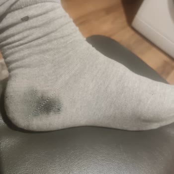 Ecco Ayakkabı Her Giydiğimde Çorapları Boyuyor