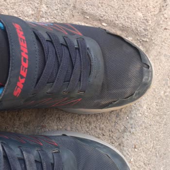 Skechers Ayakkabının Kalitesizliği Ve Kötü Hizmeti