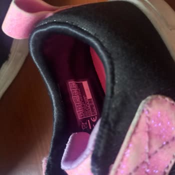 Skechers Ayakkabı Parçalandı 2 Haftada Geldiği Durum