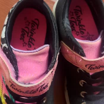 Skechers Ayakkabı Parçalandı 2 Haftada Geldiği Durum