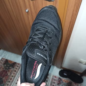 Skechers Marka Spor Ayakkabı Ayaklarımı Yaktı